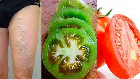 как да се лекува разширени вени с червени домати